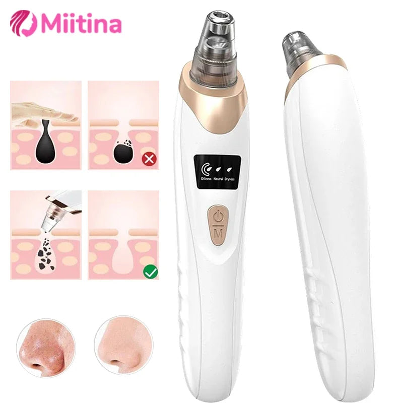 Electric Blackhead Remover Vacuum Suction - USB Facial Pore Cleaner for Acne and Pimple Extraction, Skin Care Device