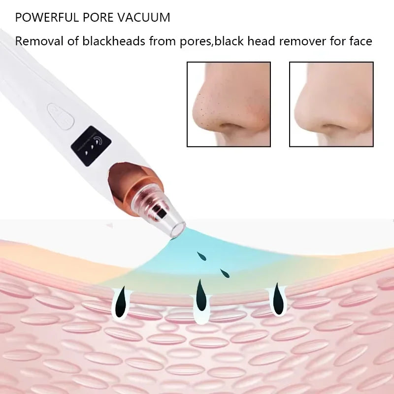 Electric Blackhead Remover Vacuum Suction - USB Facial Pore Cleaner for Acne and Pimple Extraction, Skin Care Device