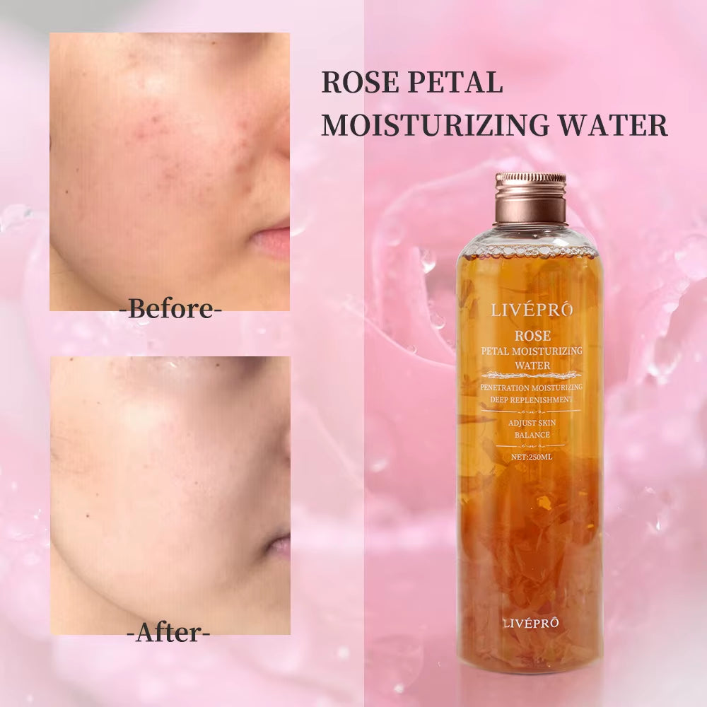 Rose Petal Water Toner and Moisturizing Essence for Skin Care